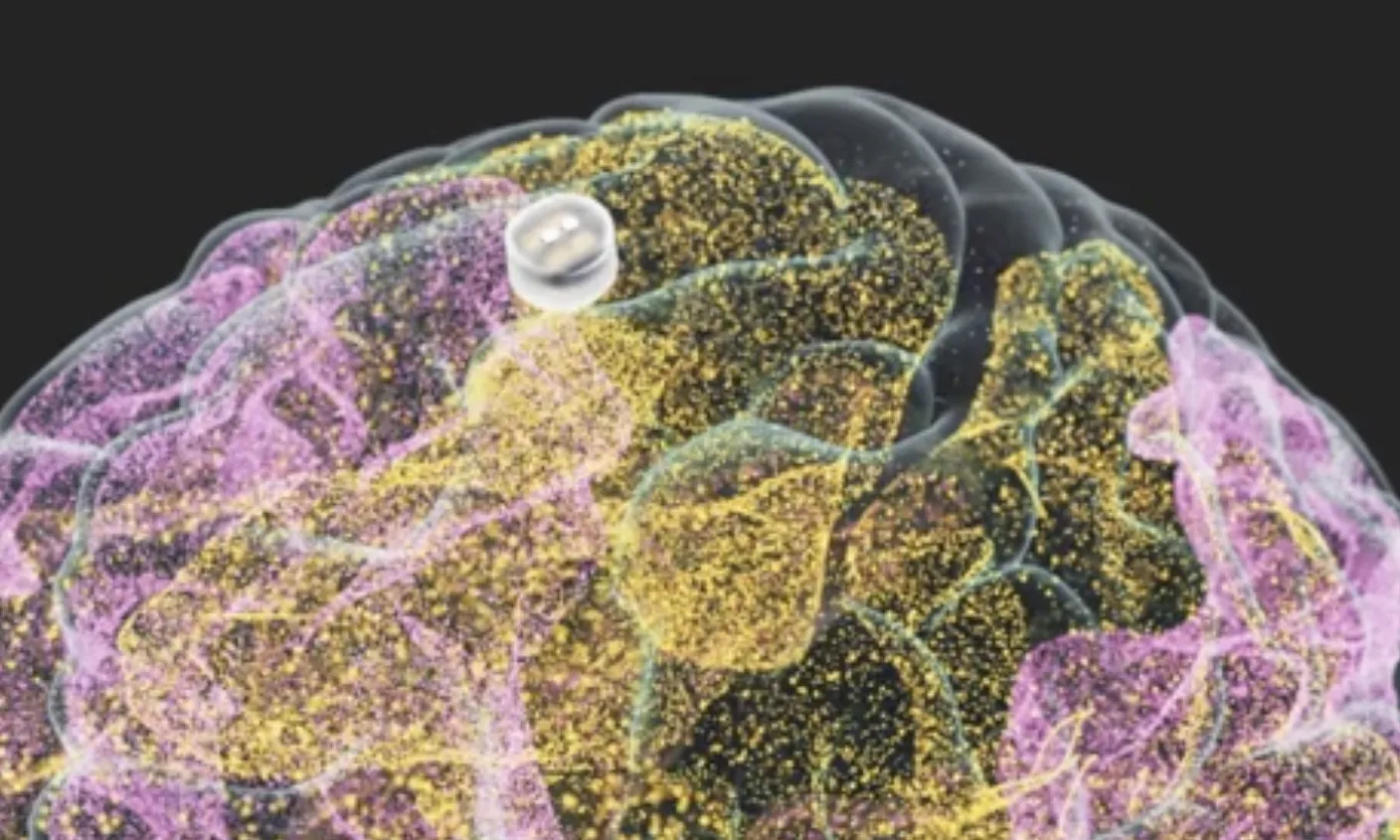 ڈپریشن کے علاج کا تخروپن